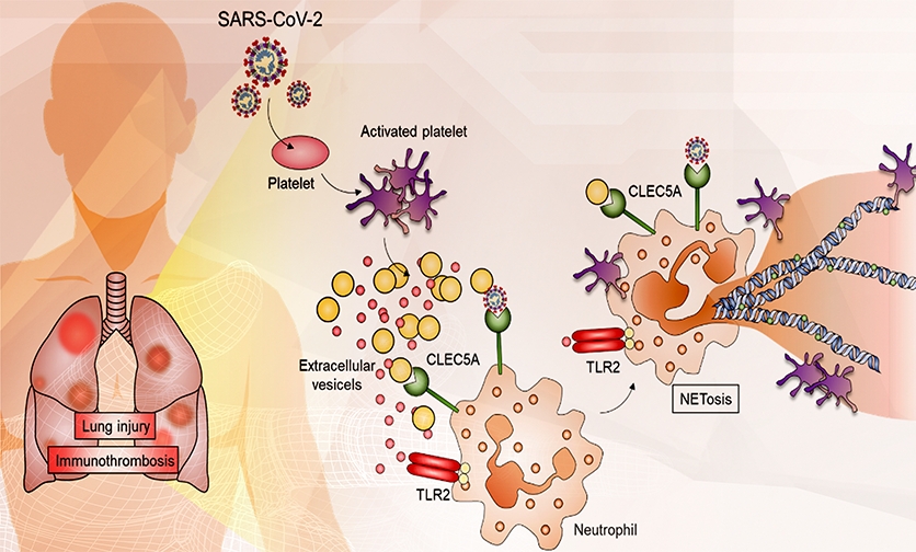 CLEC5A 和 TLR2 是 SARS-CoV-2 冠狀病毒引發肺栓塞的關鍵