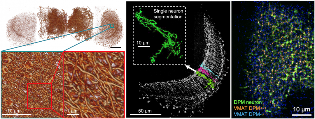 Three-Dimensional Optical Super-Resolution Microscopy: Microscopes Image a Whole Fly Brain