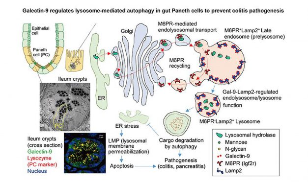 Glycosylation of Lysosomal Membrane Protein Plays a Key Role in Colitis and Pancreatitis