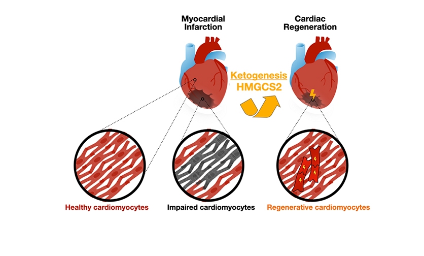 Ketogenic Gene Therapy Allows Heart Regeneration and Rejuvenation