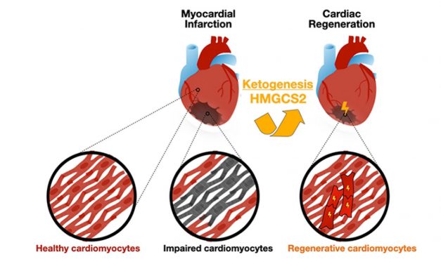 Ketogenic Gene Therapy Allows Heart Regeneration and Rejuvenation